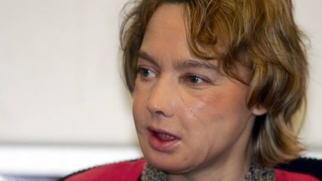 Vrouw die eerste gezichtstransplantatie kreeg, overleden